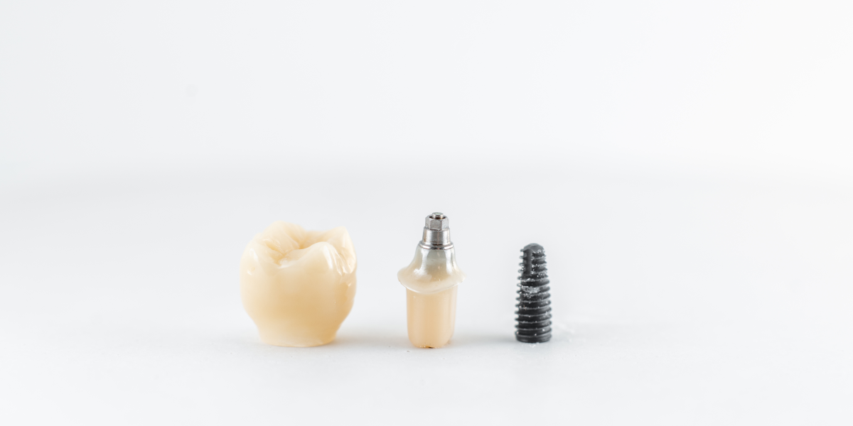 especialistas en mini implantes en houston, texas