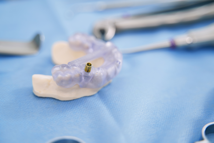 mini implantes dentales para placas de adultos mayores