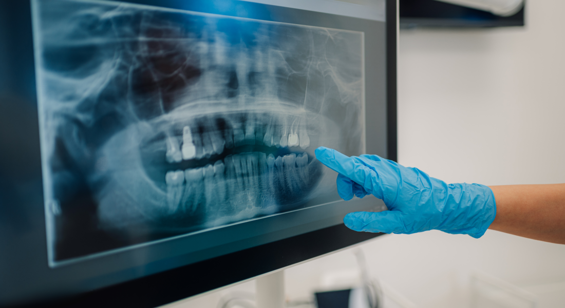 regeneracion dental biologica